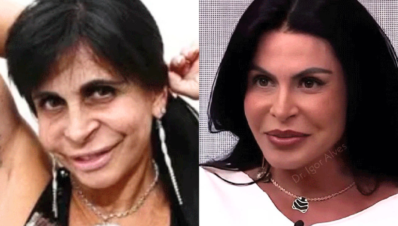 Gretchen rebate críticas sobre procedimentos estéticos e diz que é