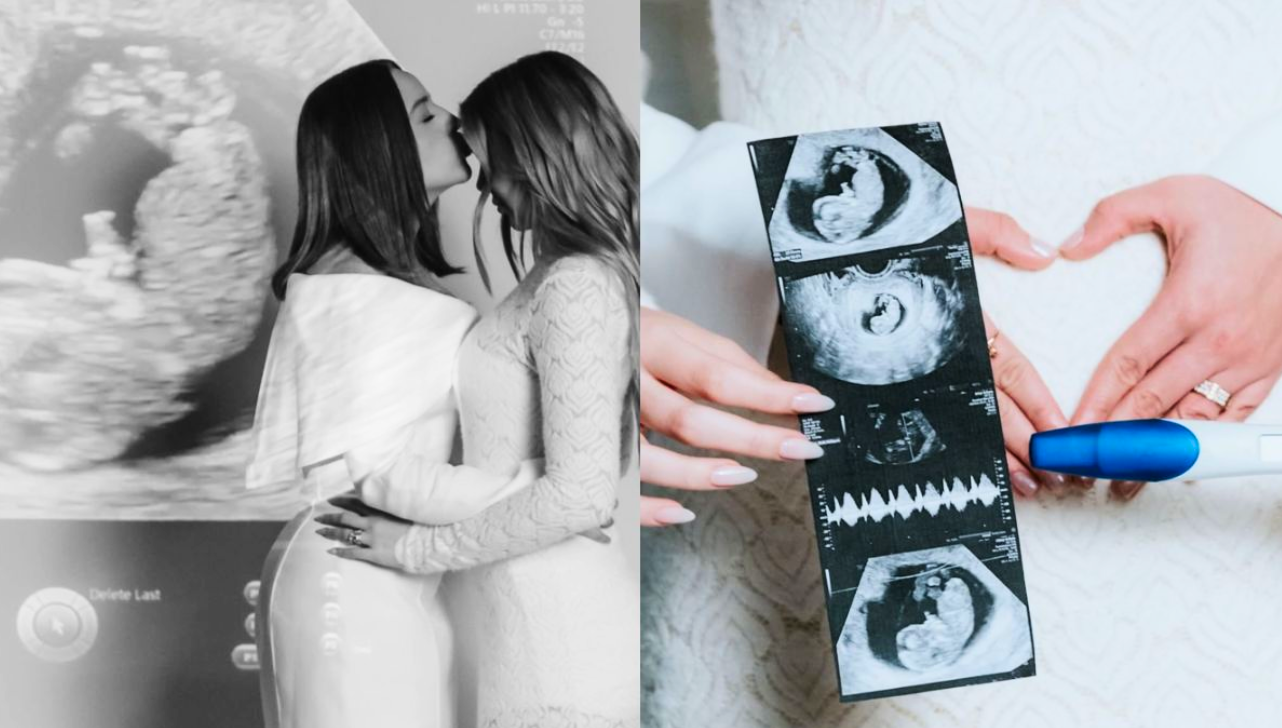 Mari Fernandez e Júlia Ribeiro anunciam que estão esperando um